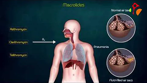 Quali sono gli antibiotici macrolidi?