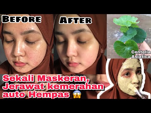 CARA MEMBUAT MASKER PEGAGAN / CENTELLA ASIATICA UNTUK JERAWAT | Resep masker organik untuk dijual