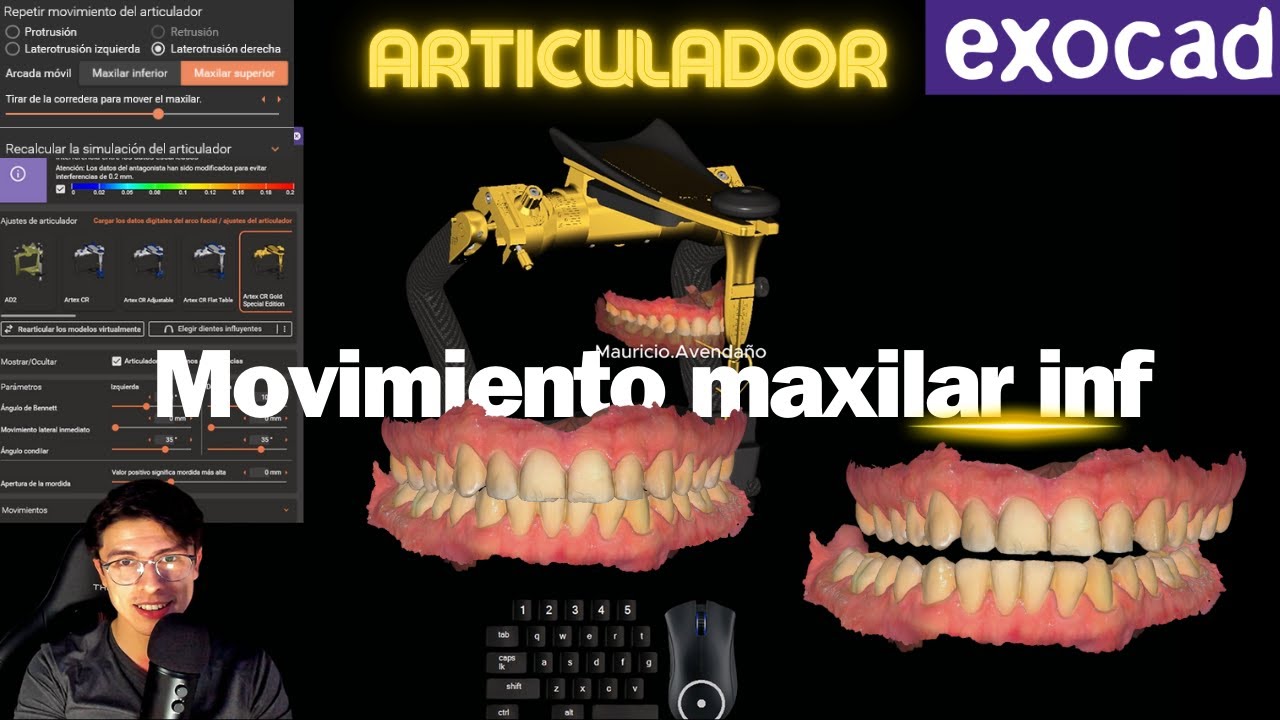 💥exocad Movimiento articulador virtual maxilar inferior!!💥