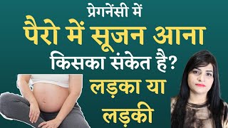 Pregnancy Me Sujan l गर्भ में बेबी बॉय होने के सटीक लक्षण I Ladka Hone Ke Lakshan l Symptoms