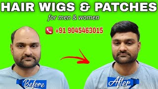 Natural Looking Non Surgical hair lose treatment |Hair Wigs & Patches for men & women, Mo-9045463015