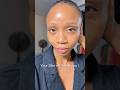 Have You Tried These Products For Dark Spots Darkspots Hyperpigmentation Skincare Have You Tried These Products For Dark Spots Darkspots Hyperpigmentation Skincare