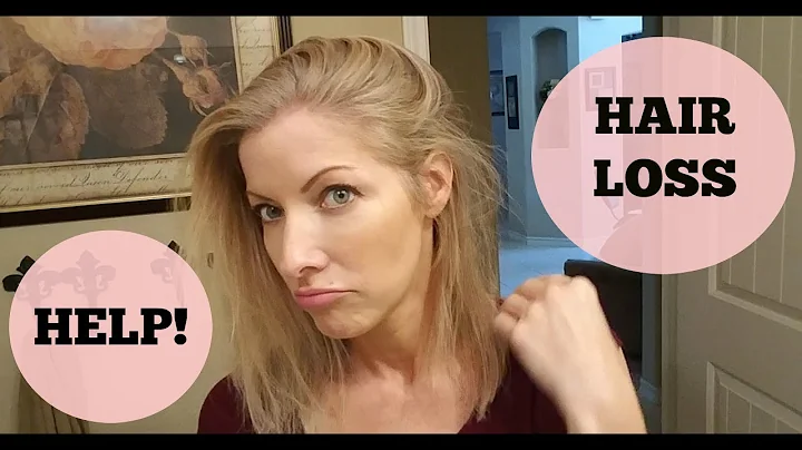 Hair Loss, Hashimotos, Graves' Disease - HELP!