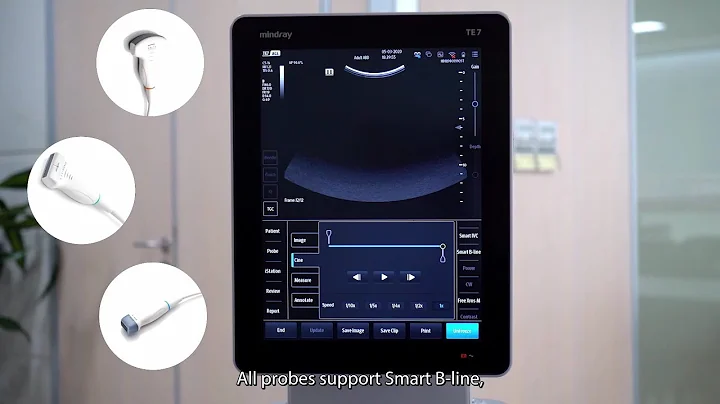 Mindray TE7 ACE-Smart B line Demo Video