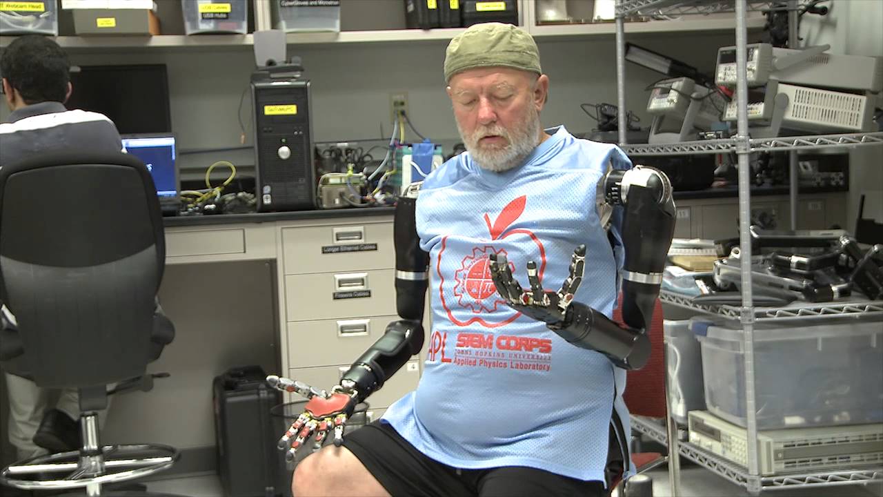 Amputee Makes History with APL's Modular Prosthetic - YouTube
