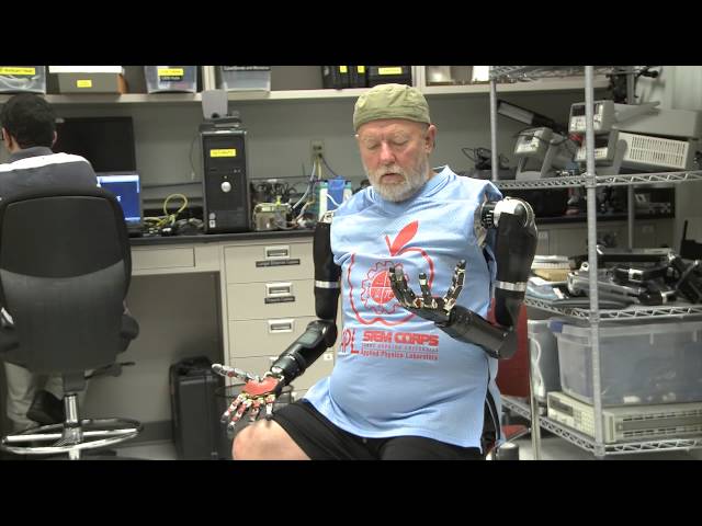 Amputee Makes History with APL’s Modular Prosthetic Limb class=