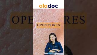 Open Pores Ka Ilaj - کھلے مسام کا علاج #shorts #openporesremedy #largeopenpores