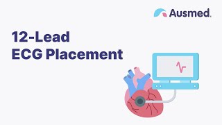 12-Lead ECG Placement | Ausmed Explains...