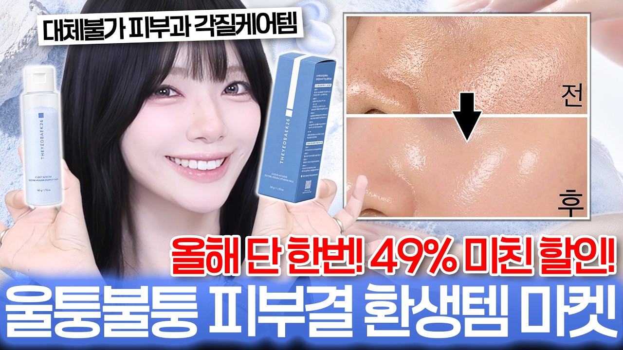 각질부각, 좁쌀요철 그만✋민감성 피부 전용 구름이 아줄렌 효소 런칭 마켓⛅ㅣ피부 요철 없애는법, 홈케어 피부관리, 더여백26