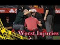 MLB \\ Worst Umpire Injuries