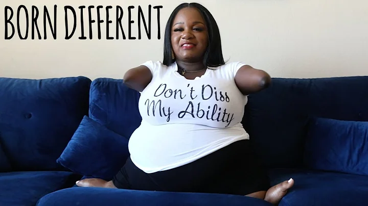 This Is How I Do Things Without Hands | BORN DIFFE...