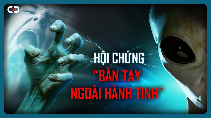 Những Hội Chứng Kỳ Lạ Nhất Thế Giới: Bàn Tay Người Ngoài Hành Tinh Bí Ẩn