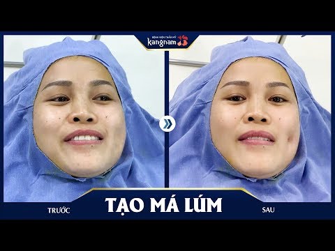 Video Tạo má lúm đồng tiền có đau không? - youtube