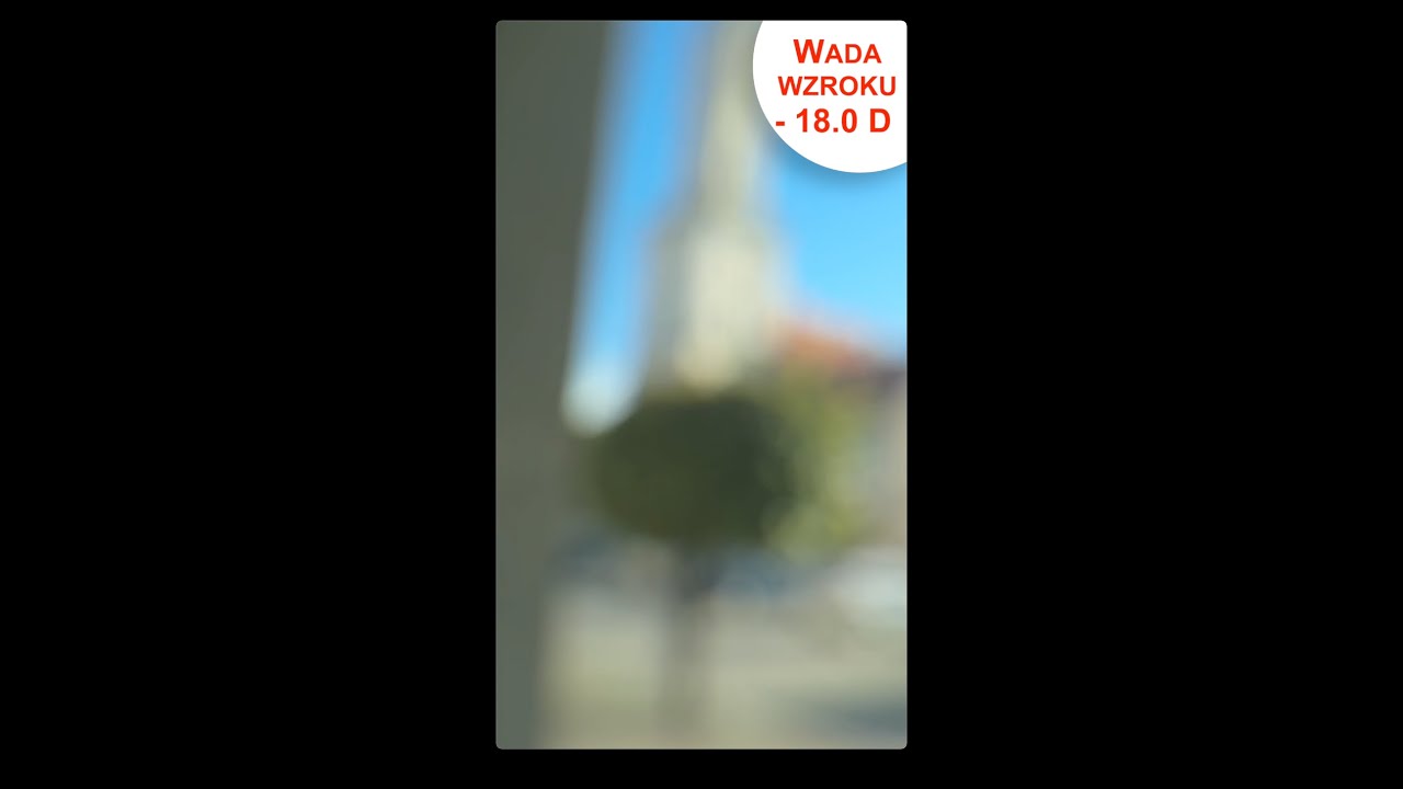 Jak Długo żyje Osoba Z Zespołem Downa Jak widzi osoba z wadą wzroku -18,00 D? - YouTube