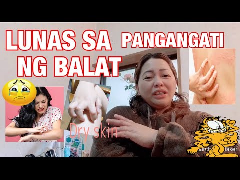 Video: Paano Haharapin Ang Pangangati