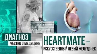 Сердце в сумке: как живут люди с искусственным сердцем | Диагноз