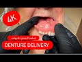 4K PROCESSING DENTURES WITH IVOCAP عربي/انكليزي  #WAXBAE #IVOCAP #DENTURES