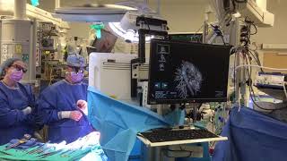 True 3D Intra-Operative Solution