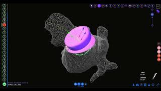 SimCardioTest Video-Demo of interactive tool for LAAO device setting selection