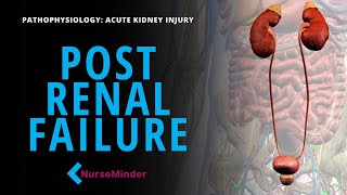 Post Renal Failure: Diagnosing and Treatment Options Nurses Need to Know