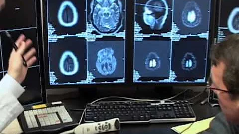 CARDIA, Stroke diagnosis & treatment  Ep. 0110
