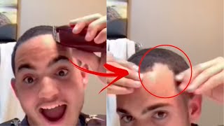 Guy accidentally cuts his hair way too short.(Regrets it)