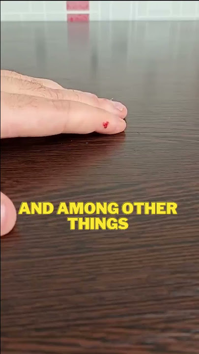 💥If you've been bitten by a hamster💥 shorts #shorts