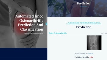 Automated Knee Osteoarthritis Prediction and Classification from X-ray Images Using Deep Learning