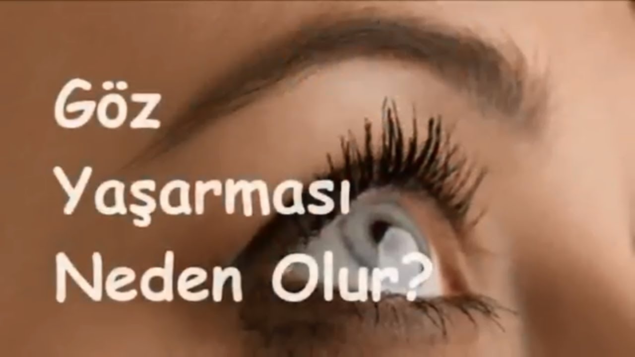 Göz Sulanması Neden Olur Nasıl Giderilir Göz Sulanması Neden Olur Nasıl Giderilir