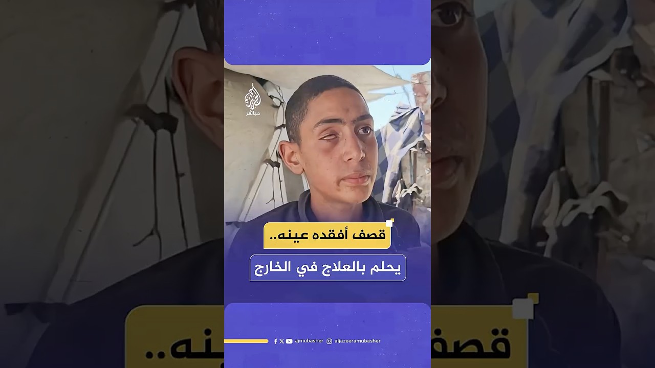 فقد عينه، لكنه لم يفقد الأمل.. محمود طفل غزّاوي يحلم بالسفر خارج غزة لتلقي العلاج.