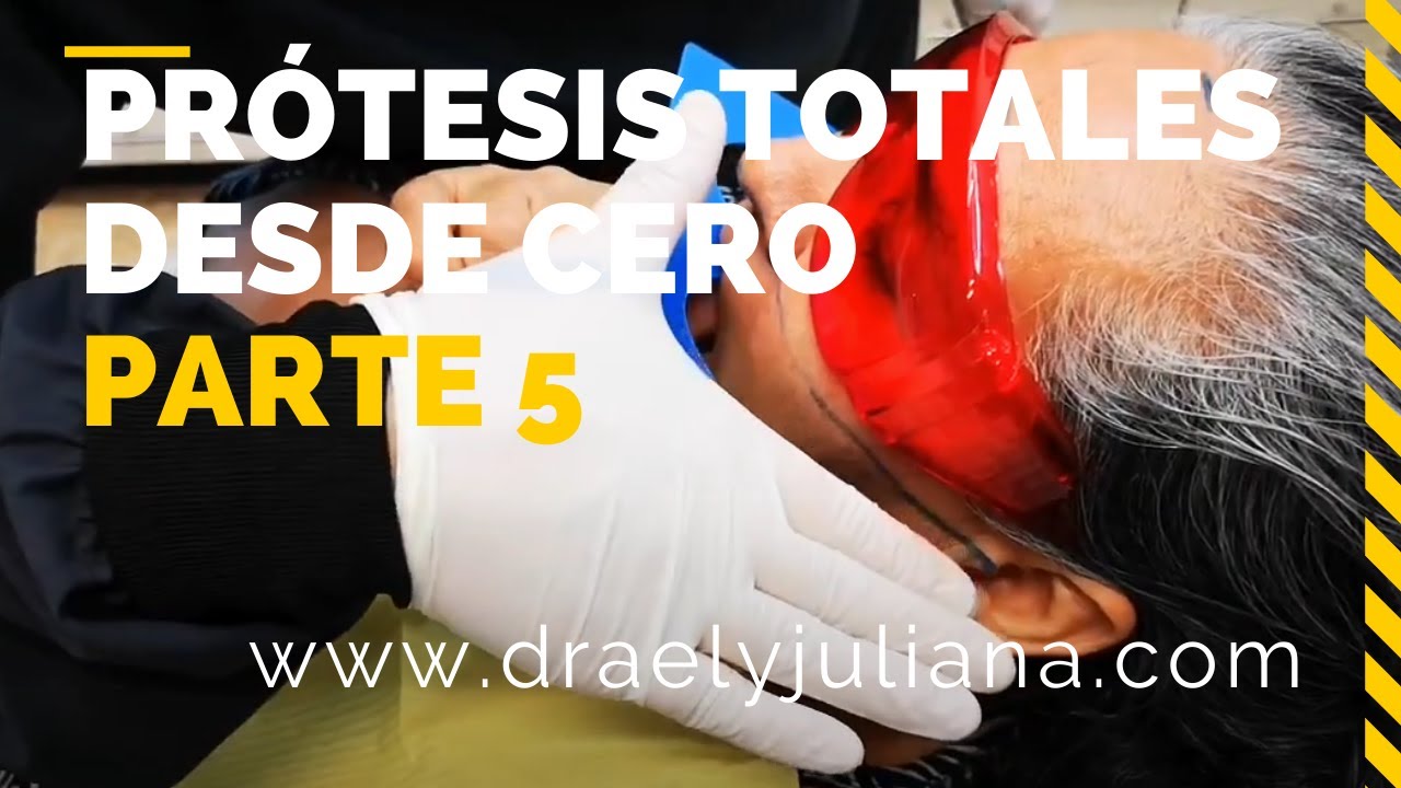 PRÓTESIS TOTALES👅Parte5 