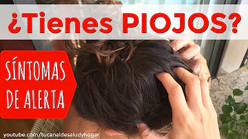 ¿Qué se siente cuando pican los piojos?