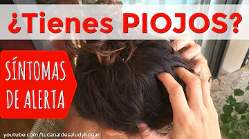 ¿Sienten los piojos como caspa?