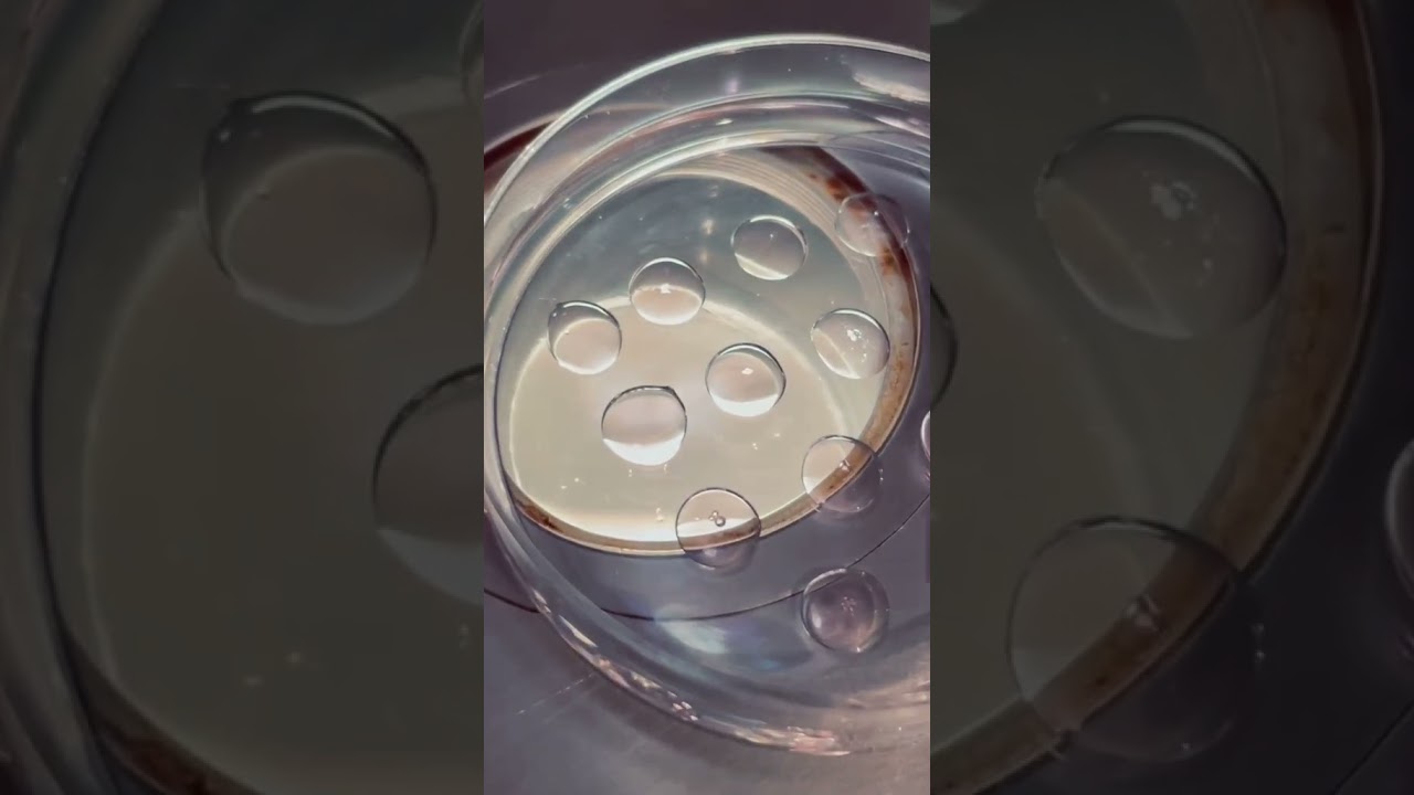 Can You See A Human Egg With The Naked Eye tiktok shaun bob