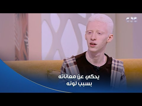 بعد نجاح فيلمه اللي كسر الدنيا تعرف على بدر محمد بطل فيلم ضي ويحكي عن معاناته بسبب لونه