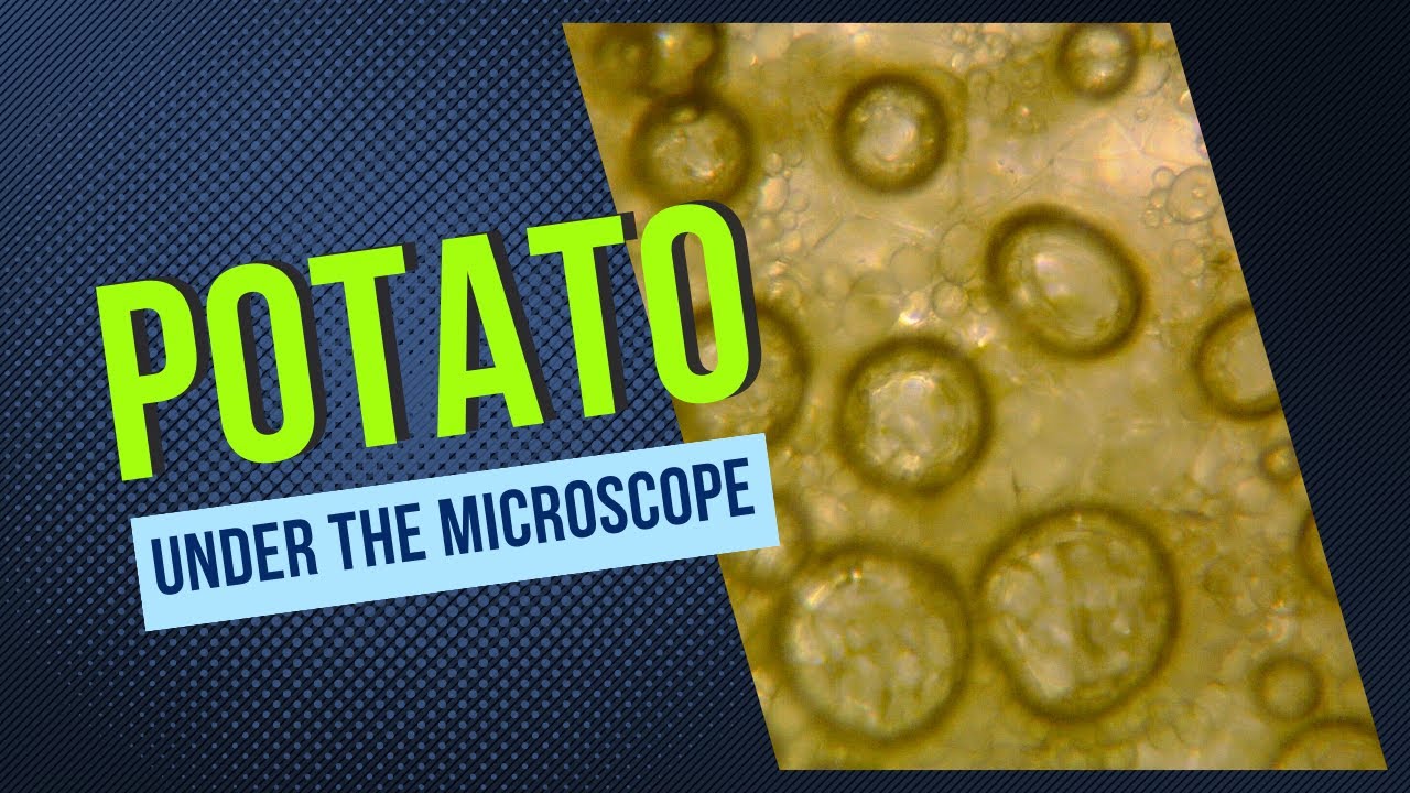Unveiling the Microscopic Marvels of Potatoes