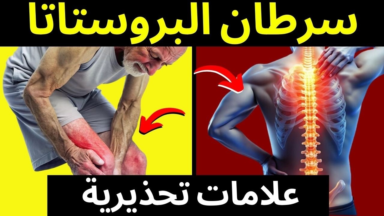 10 علامات تحذيرية لسرطان البروستاتا لا يجب تجاهلها