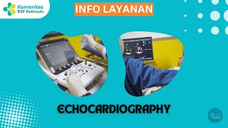 Layanan Echocardiography di RSPR_dr. Gemi Sp.JP