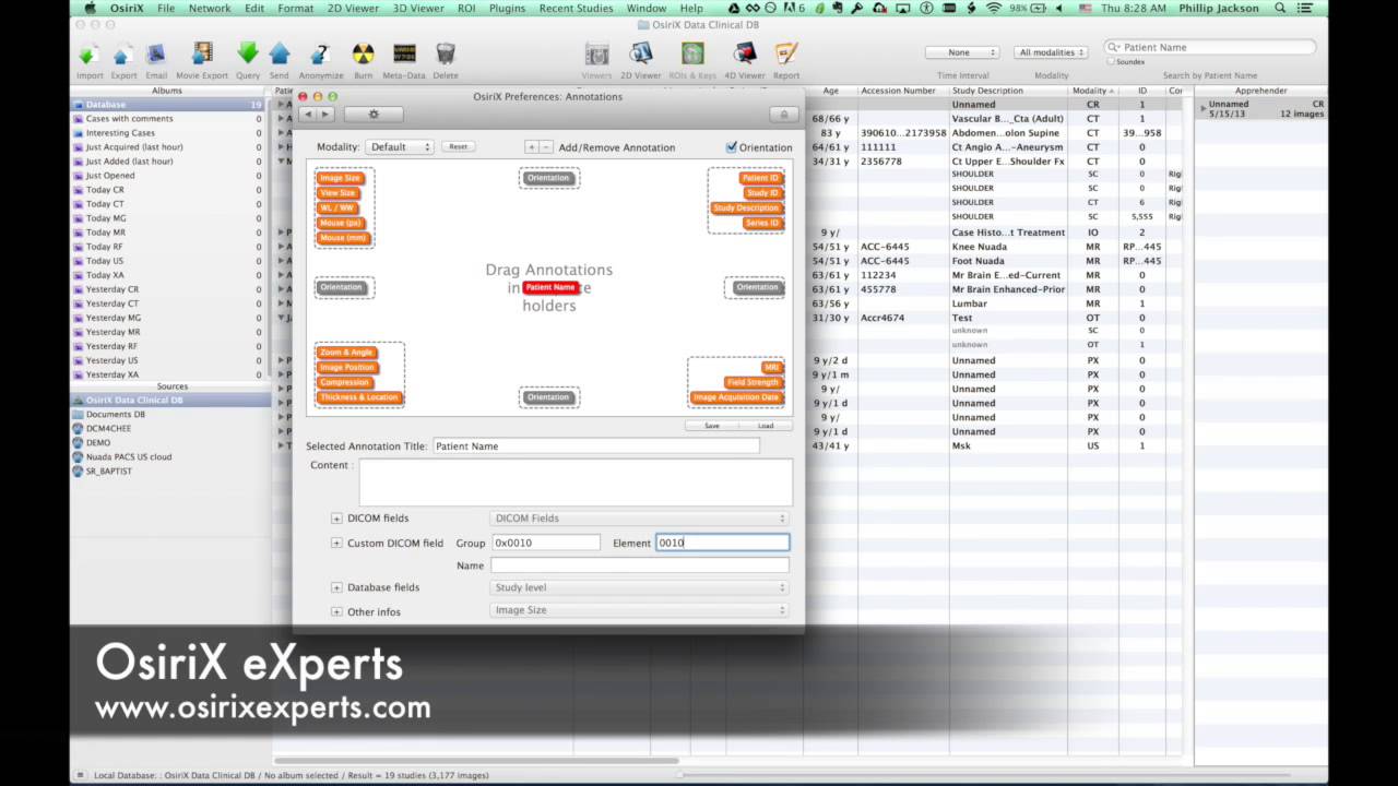 Customizing annotations in OsiriX 6.0