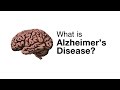 What is Alzheimer