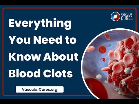 Everything You Need to Know About Blood Clots