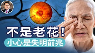 別以為是老花眼，小心是黃斑部病變！中醫教你護眼！體質調理＋明目茶飲｜四維健康
