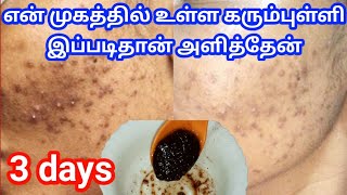 வெறும் 3நாட்களில் கரும்புள்ளிகள் மறைய |🔥Remove Acne Scars, Dark Spots, Pimple Marks, pigmentation 👍 screenshot 1