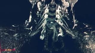 Live demo of MRI brachial plexus on optima 360 full planning and sequence details