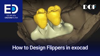 How to Design a Flipper in exocad