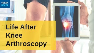 Life After Knee Arthroscopy