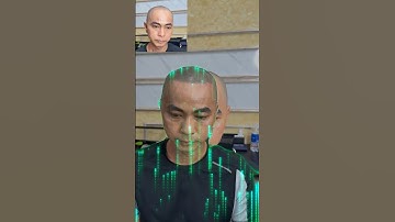 Quên đi nỗi lo chữa hói, tự tin hơn tại vnscalp đẳng cấp xăm tóc thế giới tại việt nam #xămtóc