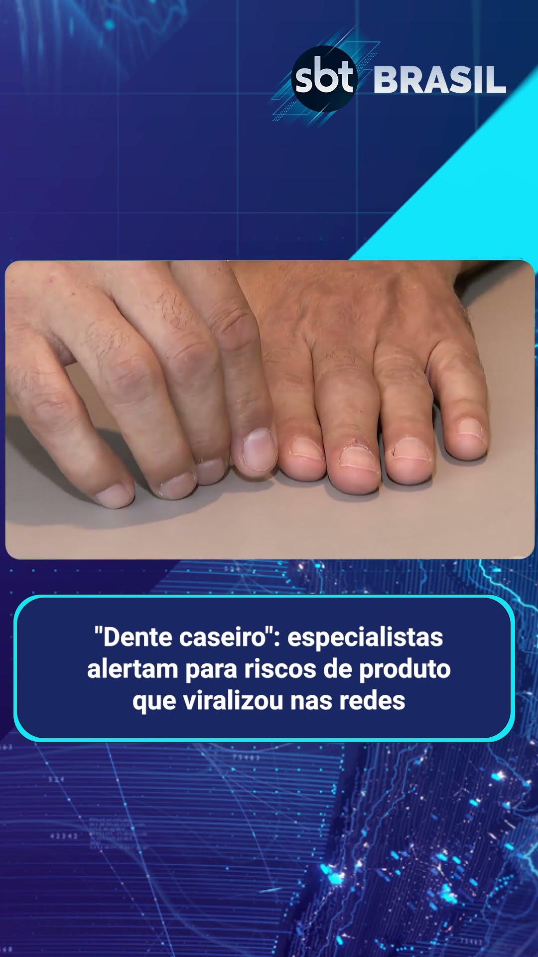 Venda de resinas em e-commerce é alvo de denúncia do Conselho de Odontologia | SBT Brasil (08/02/25)