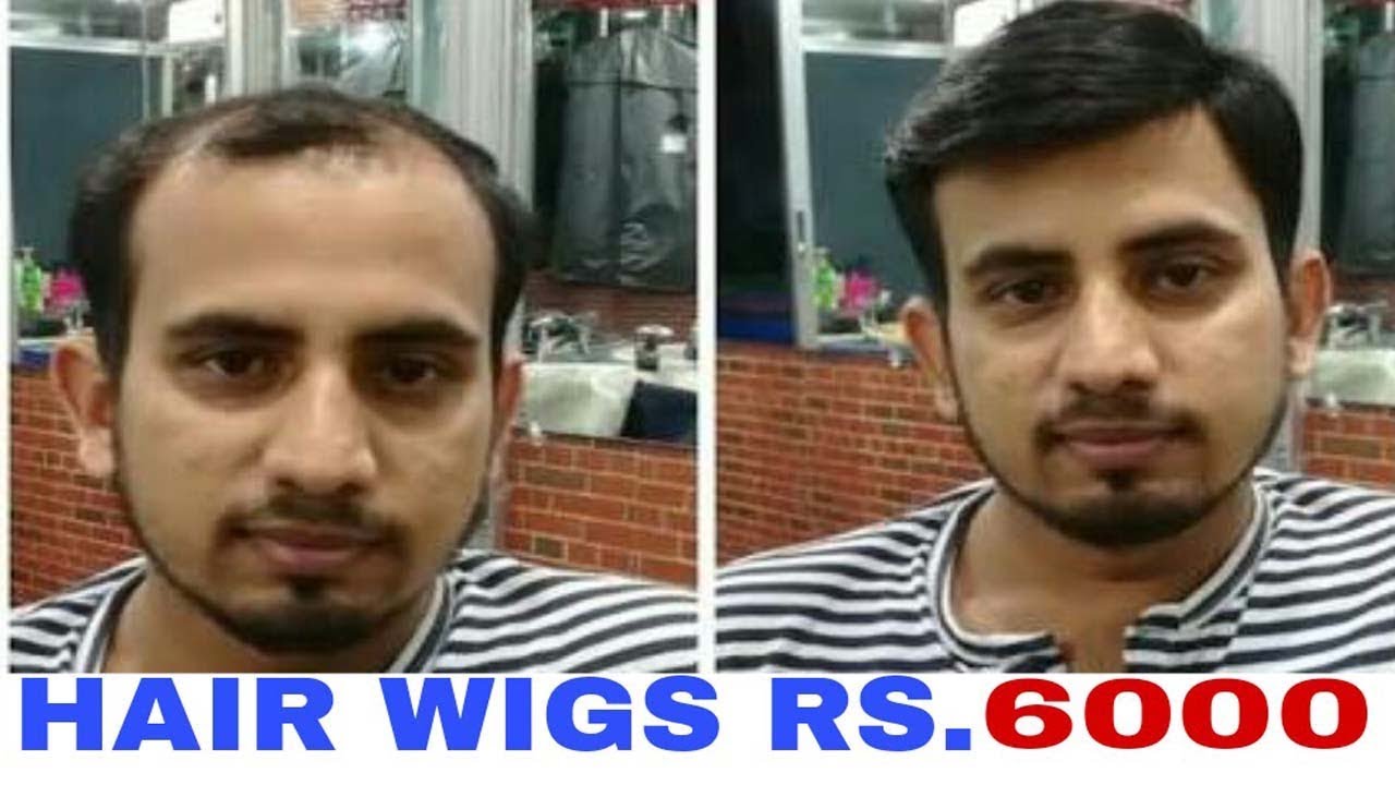 Hair wigs in delhi . Rs. 6000 . 9990115900 . Hair wigs in delhi . Hair