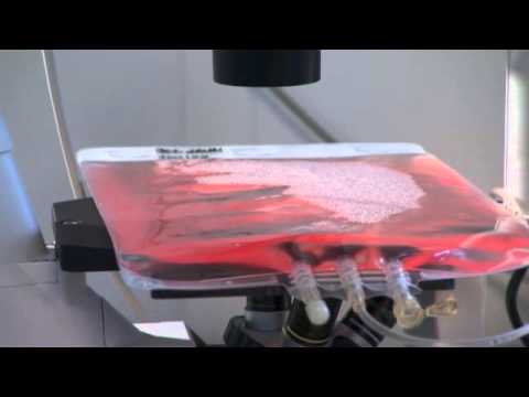 Video: Wo kommen dendritische Zellen vor?